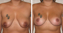 Before & After Photos